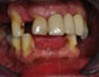 cirugia-3b_big