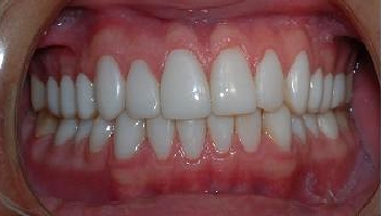 antes_despues002_b antes_despues002_b