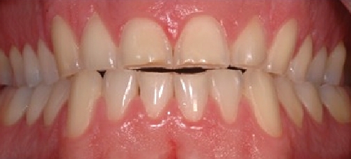 antes_despues005_a antes_despues005_a