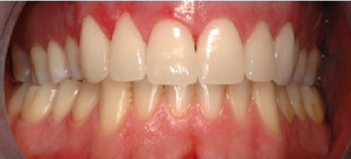 antes_despues005_b antes_despues005_b
