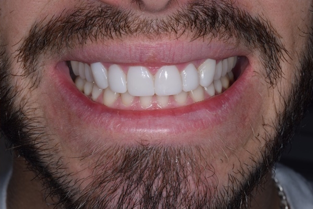 antes_despues006_b antes_despues006_b